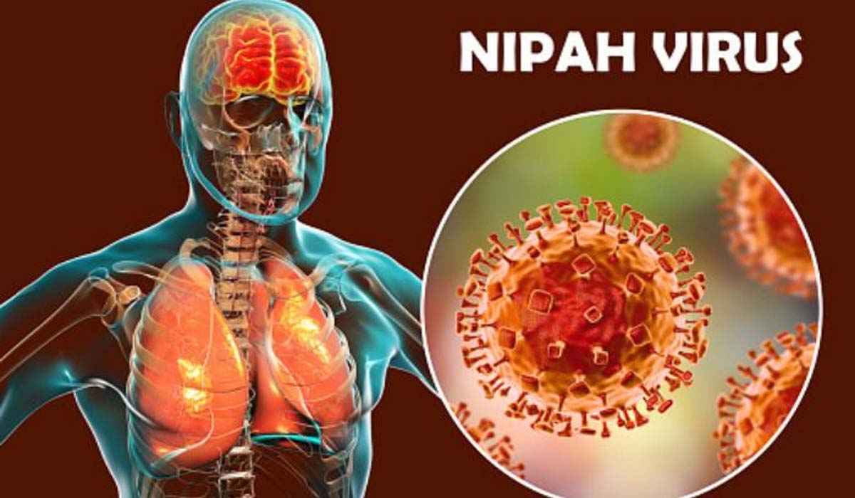 Nipah Virus | కలకలం సృష్టిస్తున్న నిపా..! వైరస్‌ లక్షణాలు ఎలా ఉంటాయ్‌..? చికిత్స ఏంటంటే..?